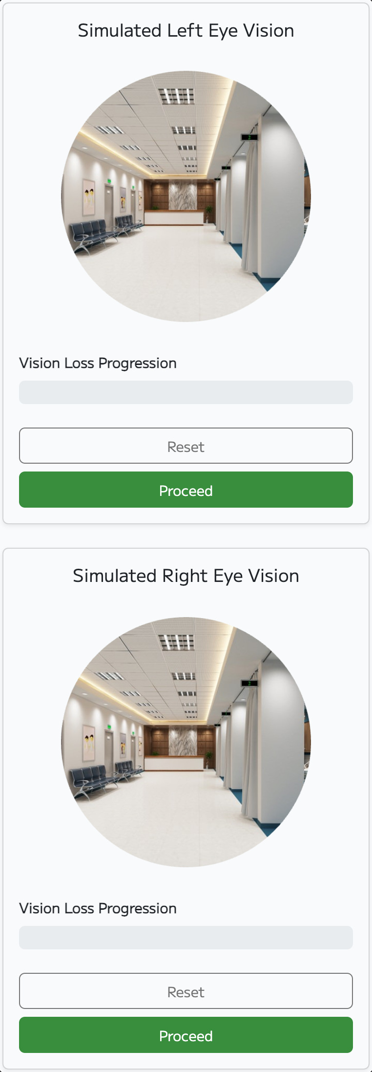 Web-based glaucoma vision simulation on Smartphone screen showing tunnel vision caused by visual field loss