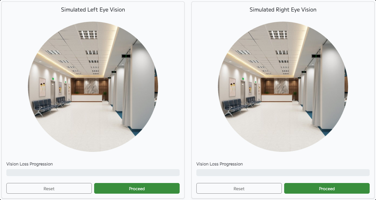 Web-based glaucoma vision simulation on PC screen showing tunnel vision caused by visual field loss